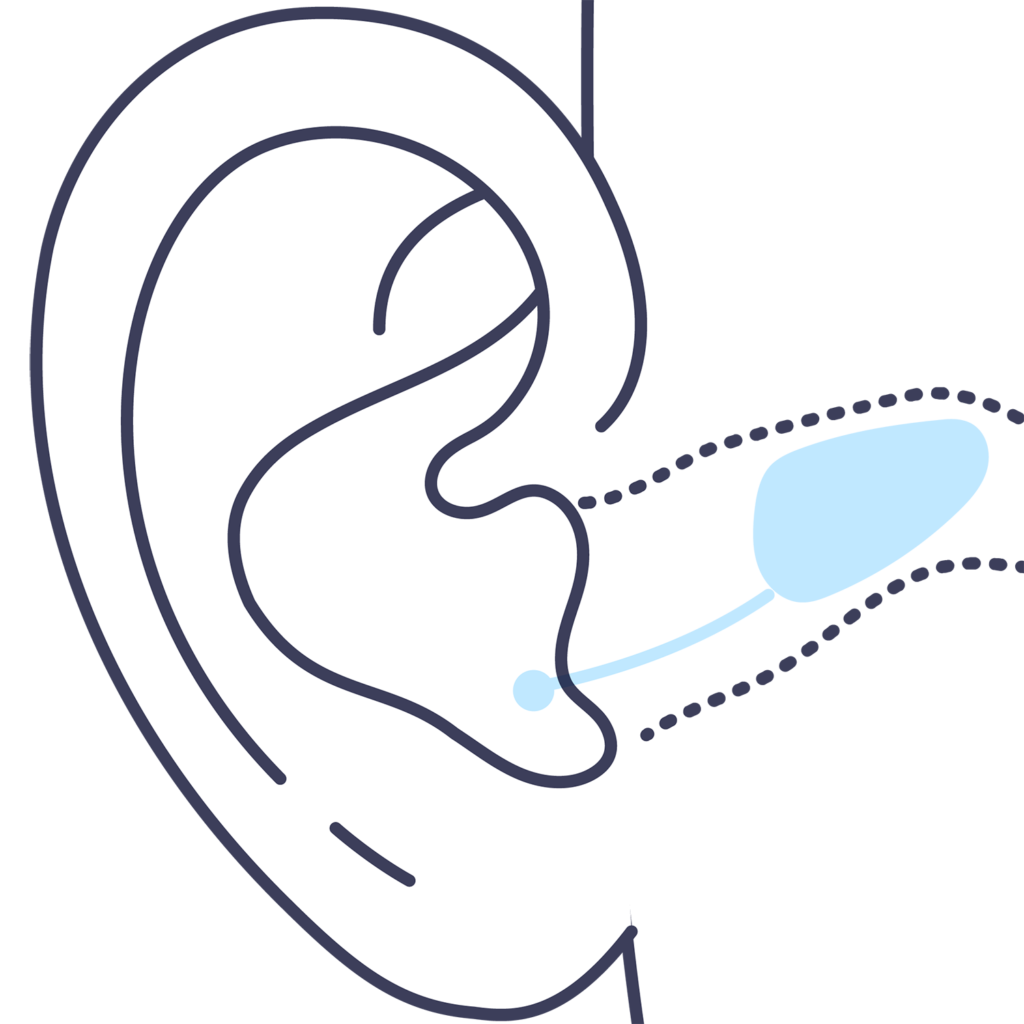 Inner hearing aid